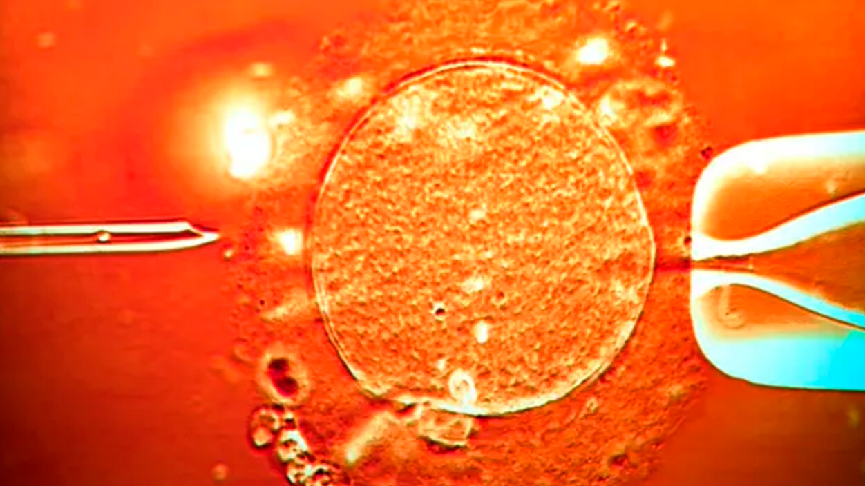 පිළිකා පරිත්යාගශීලියා