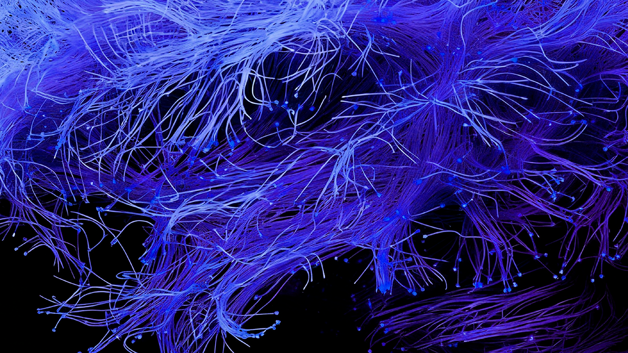 Conexión cerebro computador